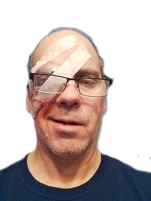 Bad Eye Day